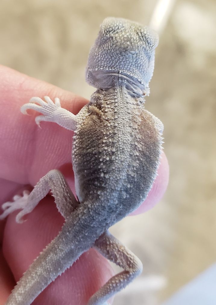 lack of pigment