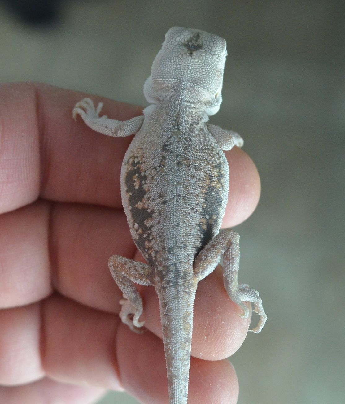 lack of pigment